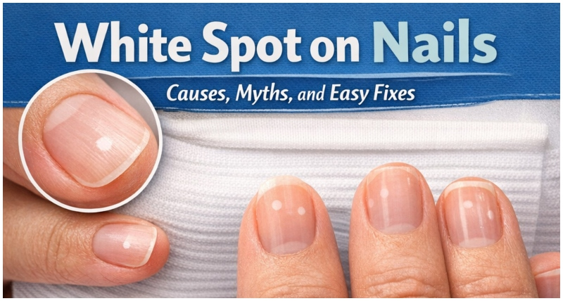 White Spot on Nails